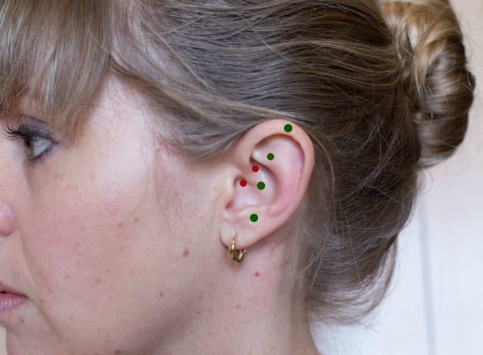 Ear Piercing Cures Migraines? | Live 